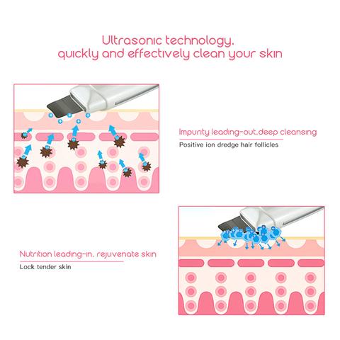 Ultrasonic Skin Scrubber Face Cleanser